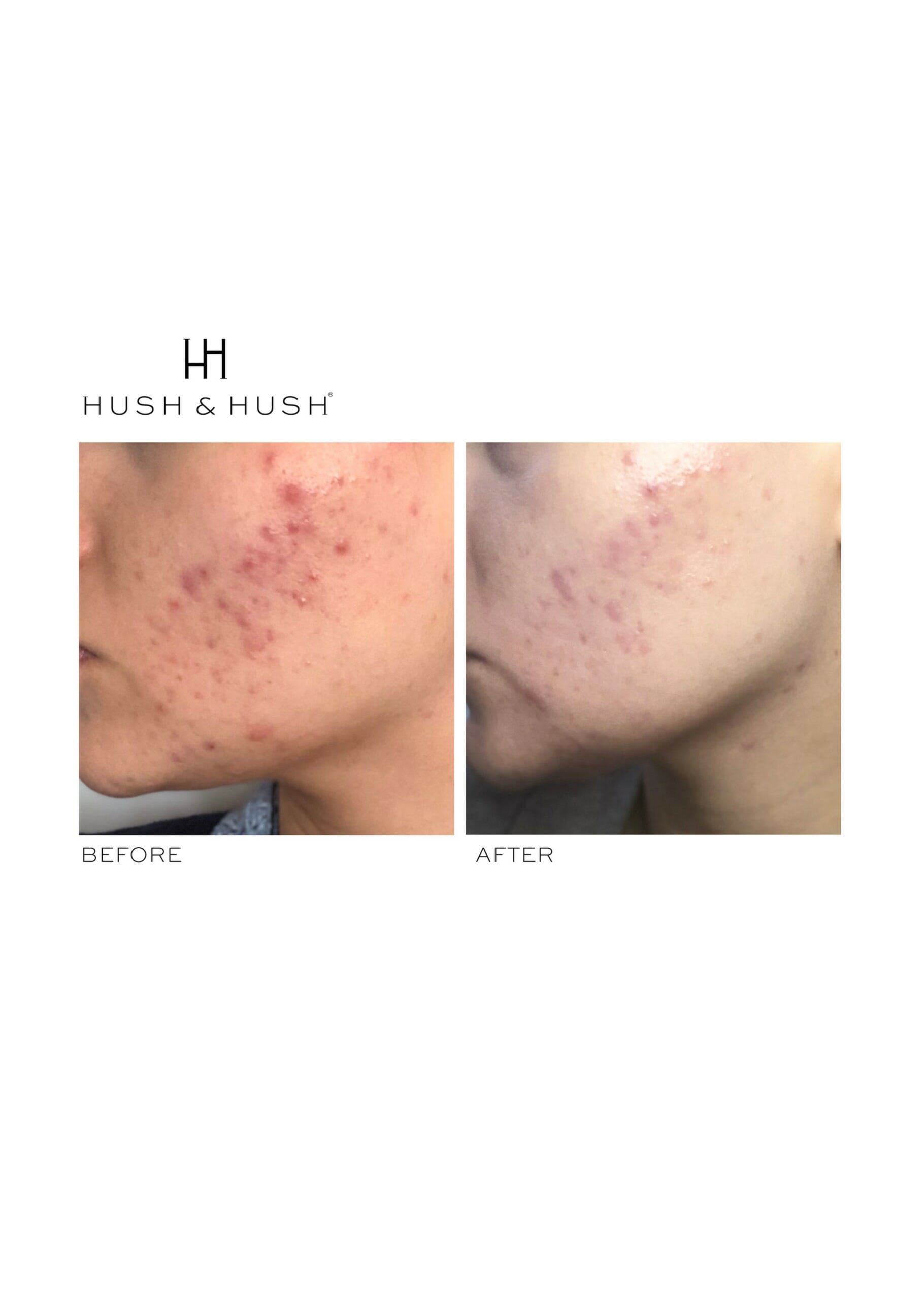 SkinCapsule™ CLEAR+ - HUSH & HUSH – Image 5