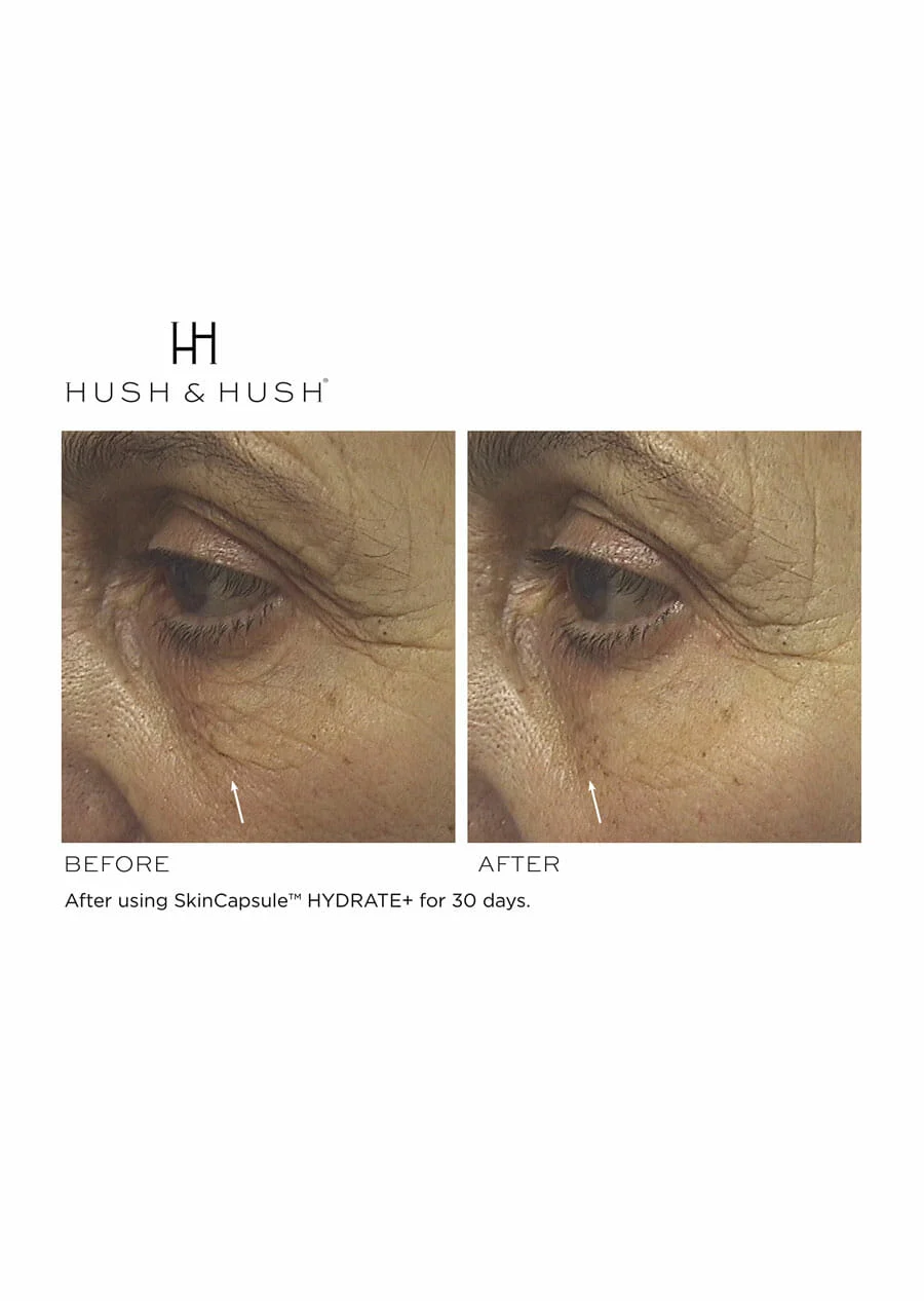 SkinCapsule  HYDRATE+ - HUSH & HUSH – Image 5
